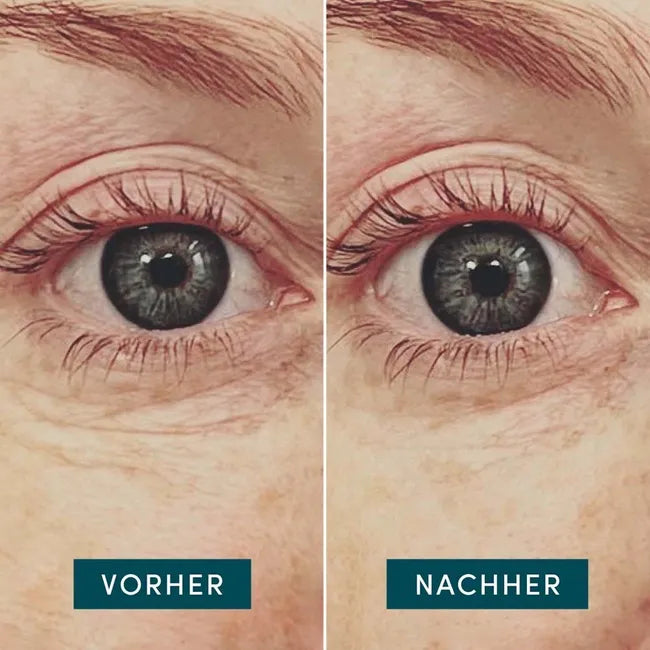 APRICOT | Wiederverwendbare Augen Pads mit Hyaluron - 30x wiederverwendbar