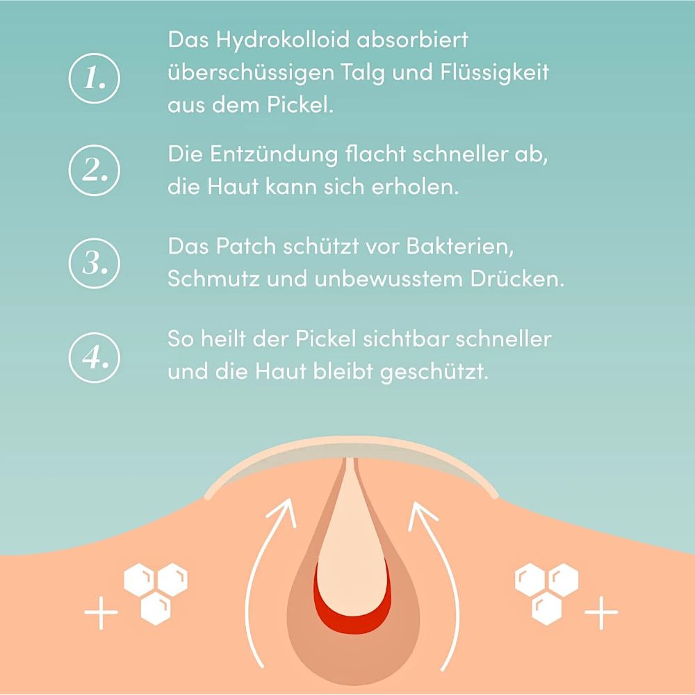 APRICOT I Pickelpflaster – einfach gegen Pickel – 72 stück