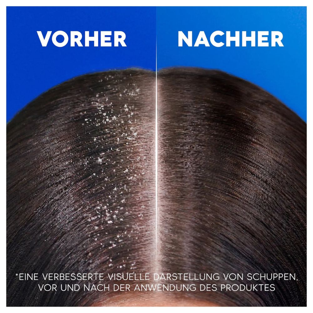 Head & Shoulders | Shampoo 2-in-1 Classic Clean - 250 ml