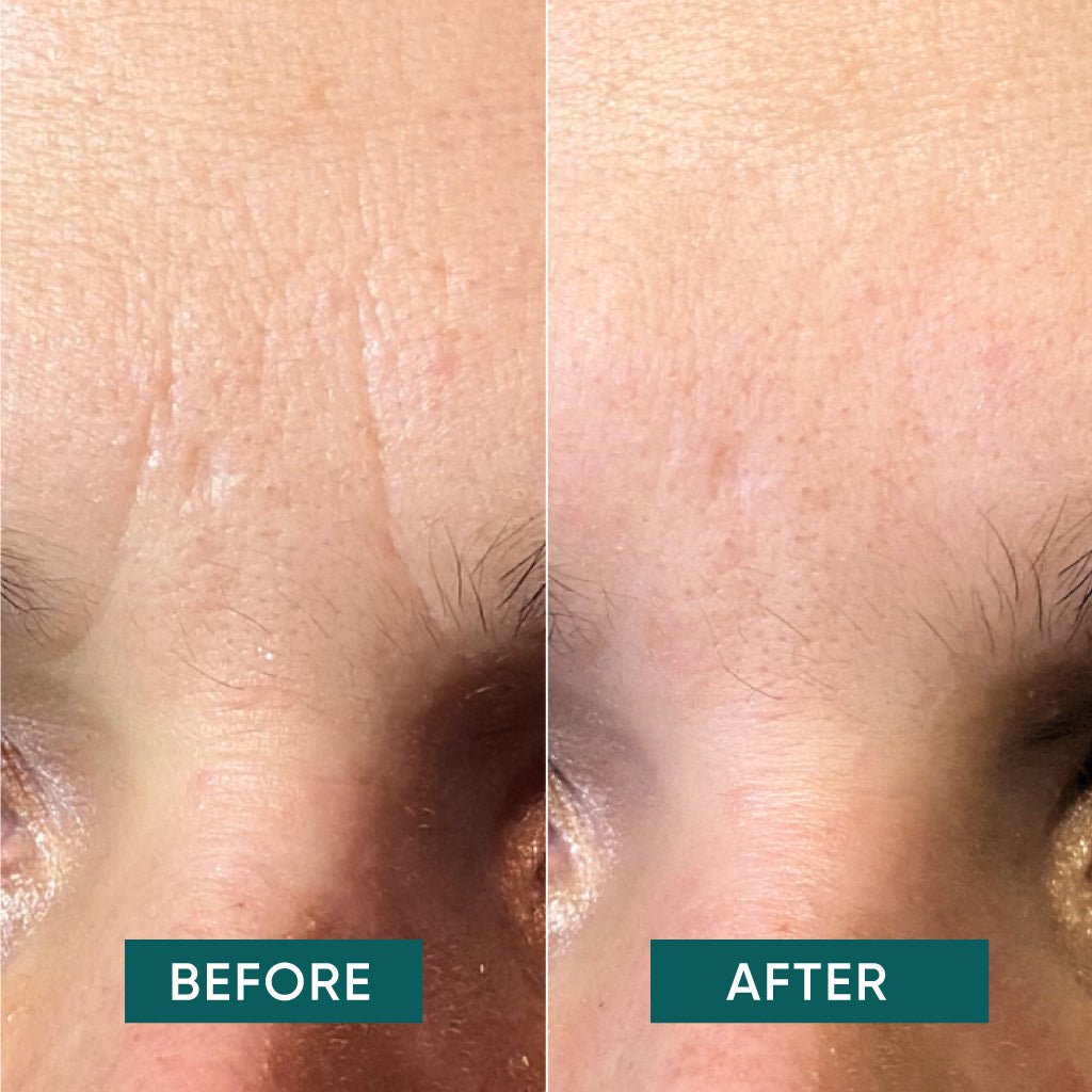 APRICOT I Zornesfalten Pads "it's a skin-vestment" mit Niacinamid – 100 Stück